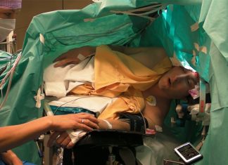 craniotomy singing