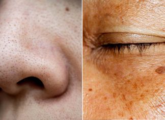 skin issues
