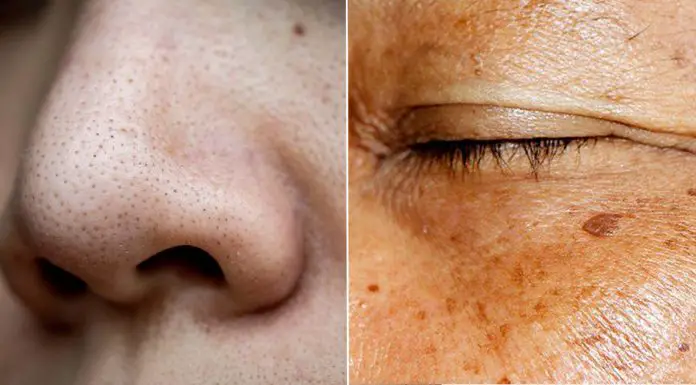 skin issues