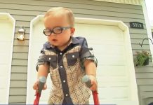 toddler-uses-crutches