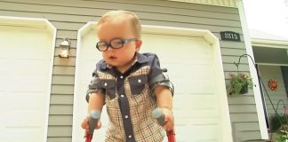 toddler-uses-crutches