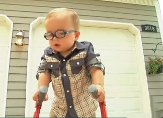 toddler-uses-crutches