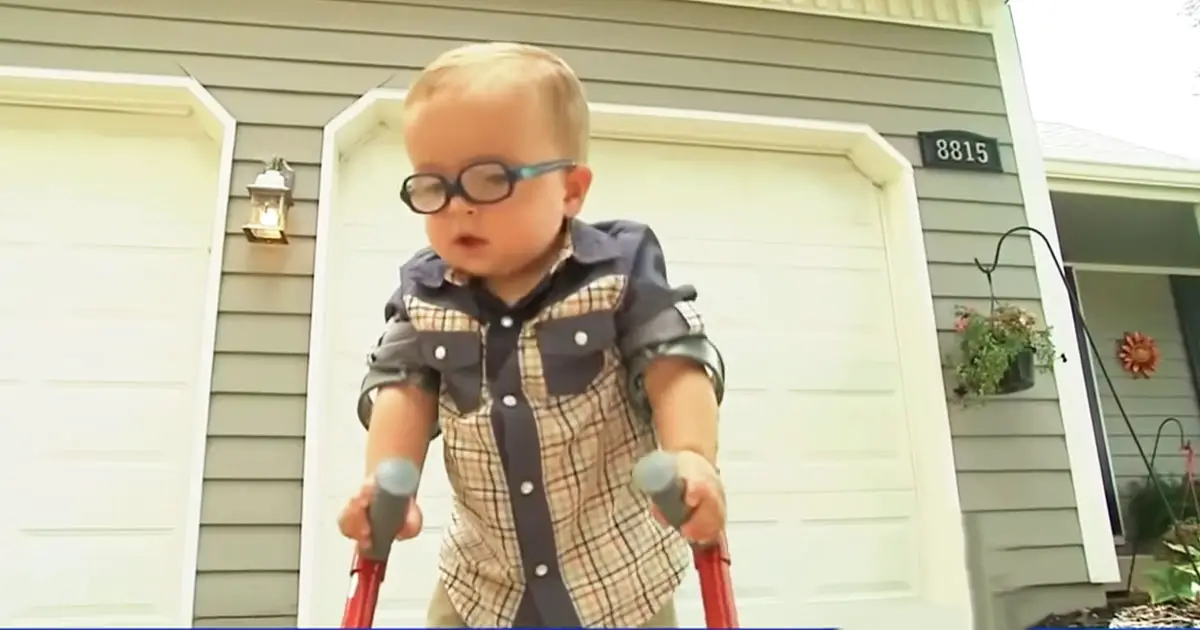 toddler-uses-crutches