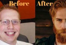 beard-transformation