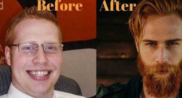 beard-transformation