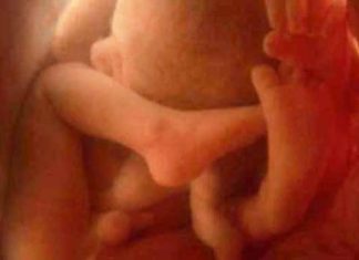 /womb-life