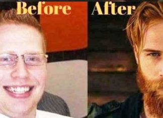 beard-transformation